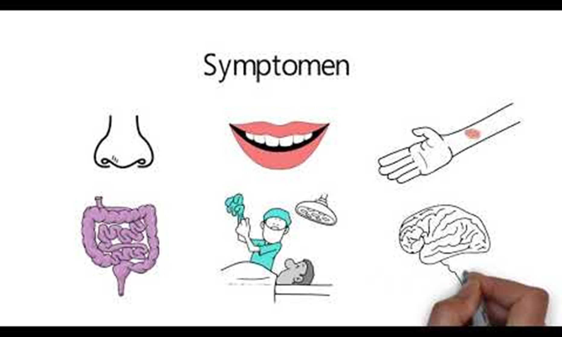 Bloedplaatjesafwijkingen - Hematologie-wijzer